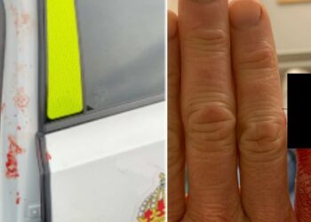 Bet av polis finger – döms till fängelse