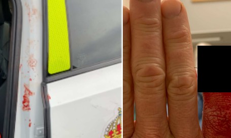 FOTO: Polisens förundersökning